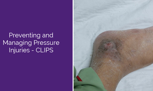 Preventing and Managing Pressure Injuries